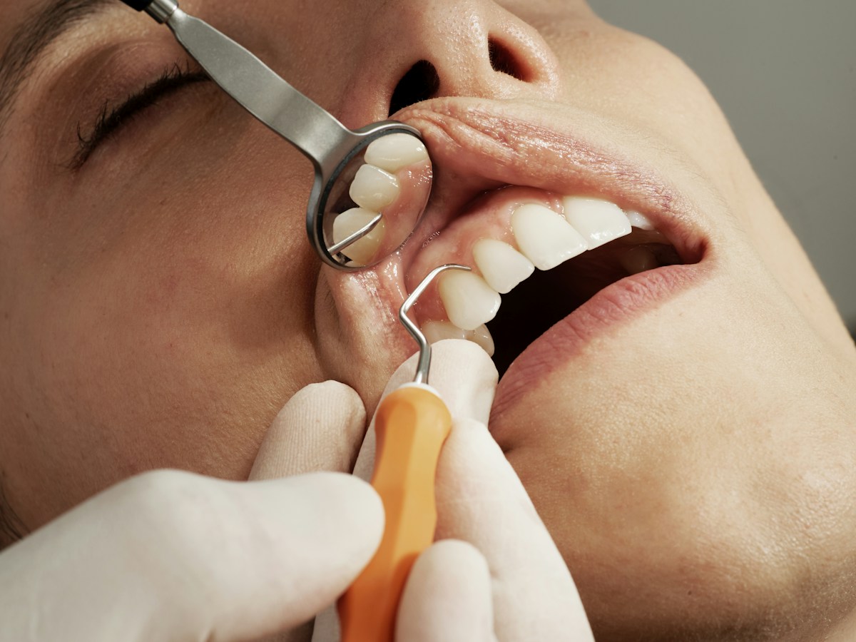 Stock photograph of a dental examination, not a client treatment or reported outcome